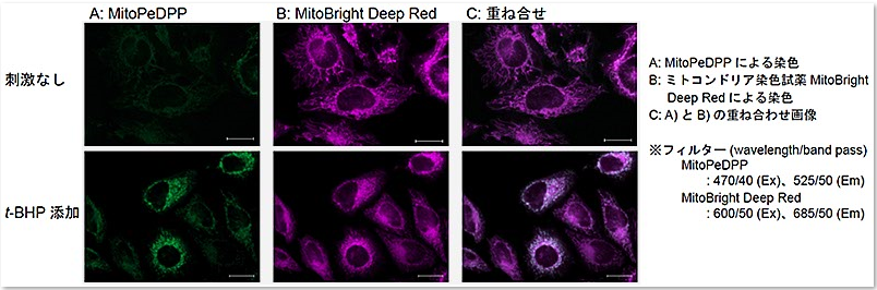 MitoPeDPP